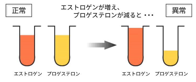 なぜ乳腺症になるのか